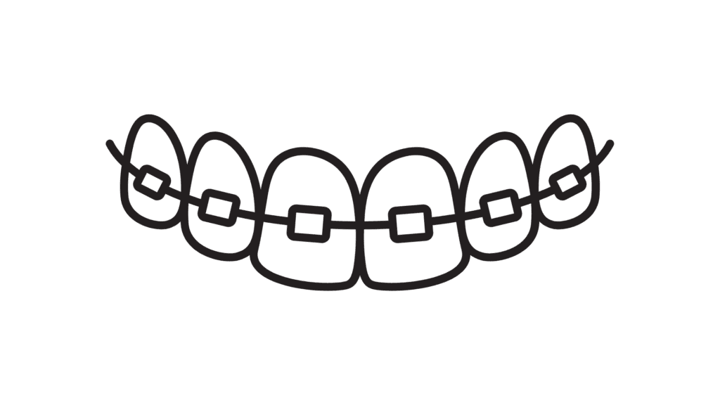 cartoon braces