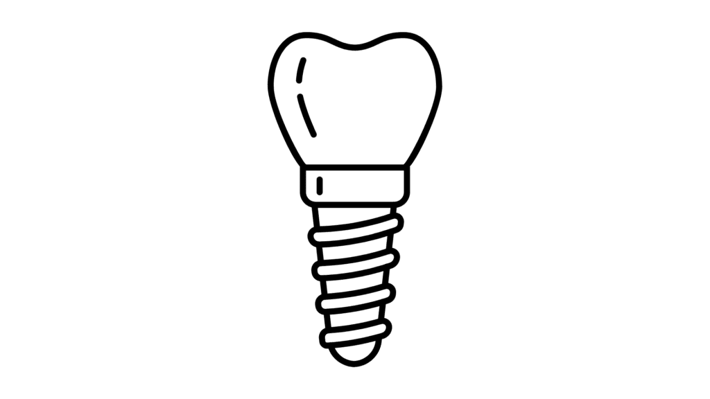 dental implant