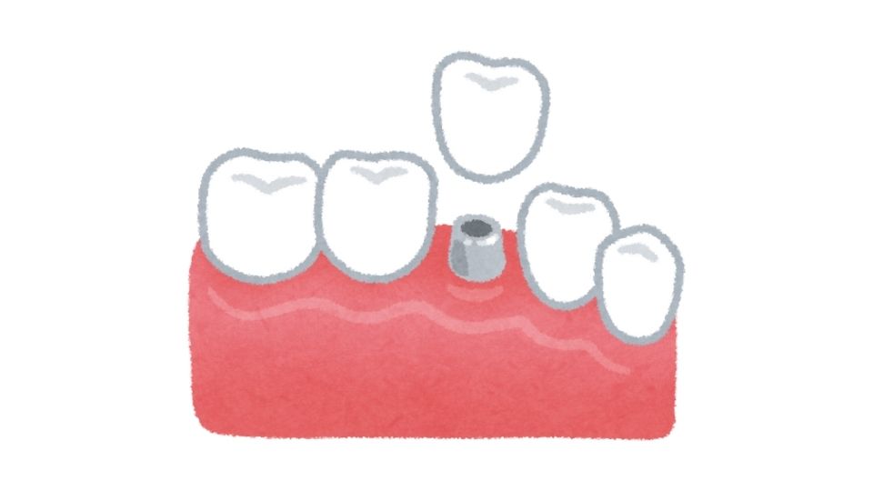 dental cartoon