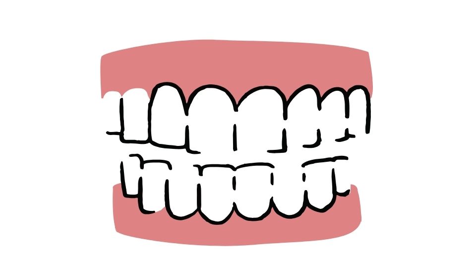 dental cartoon