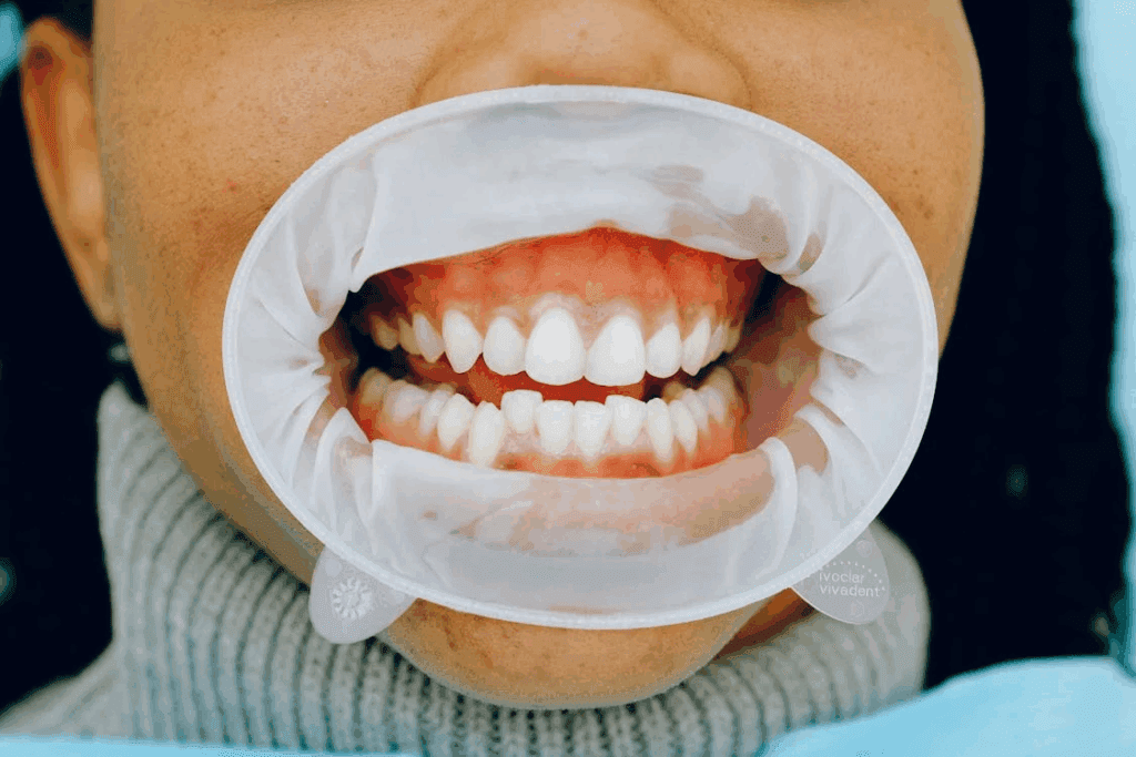 Dental Treatments
